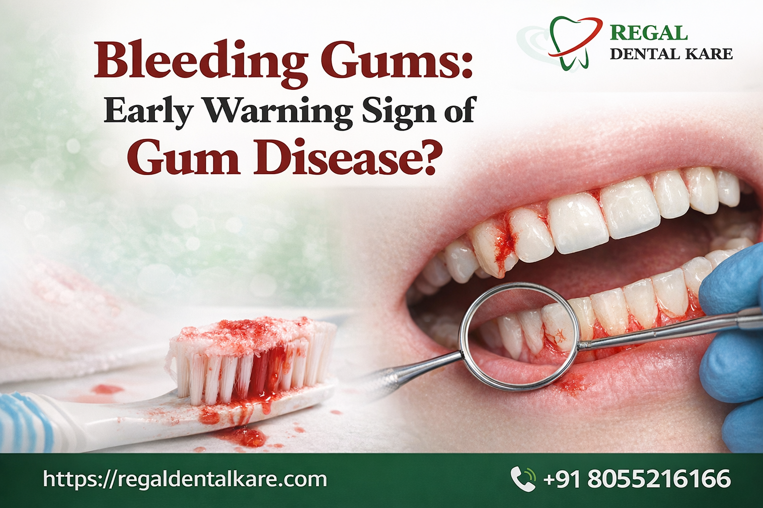 Bleeding Gums: Early Warning Sign of Gum Disease? - Regal Dental Kare Blog